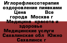 Иглорефлексотерапия, оздоровление пиявками › Цена ­ 3 000 - Все города, Москва г. Медицина, красота и здоровье » Медицинские услуги   . Сахалинская обл.,Южно-Сахалинск г.
